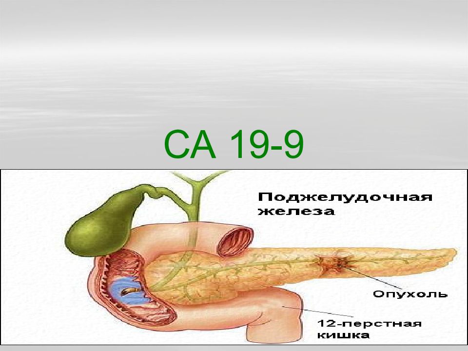 Сайт 19 9. Са19-9 онкомаркеры. Показатели опухолевого маркера са-19-9. Са 19-9. Са 19-9 и холестаз.