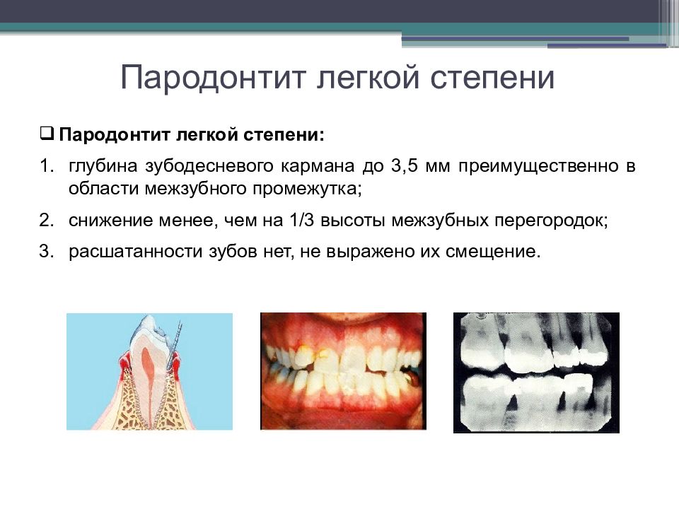 Хирургические методы лечения заболеваний пародонта презентация