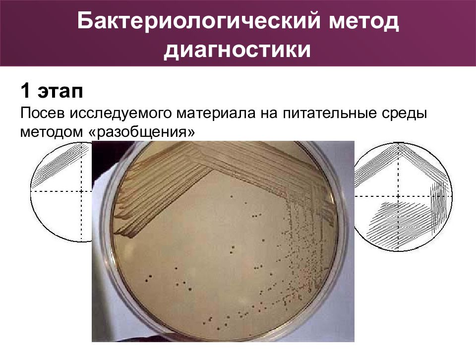 Схема посева мочи