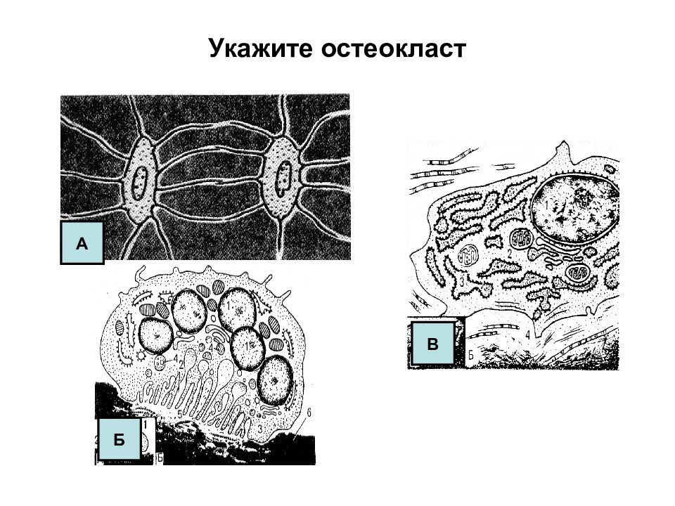 Клетка костной ткани остеоциты