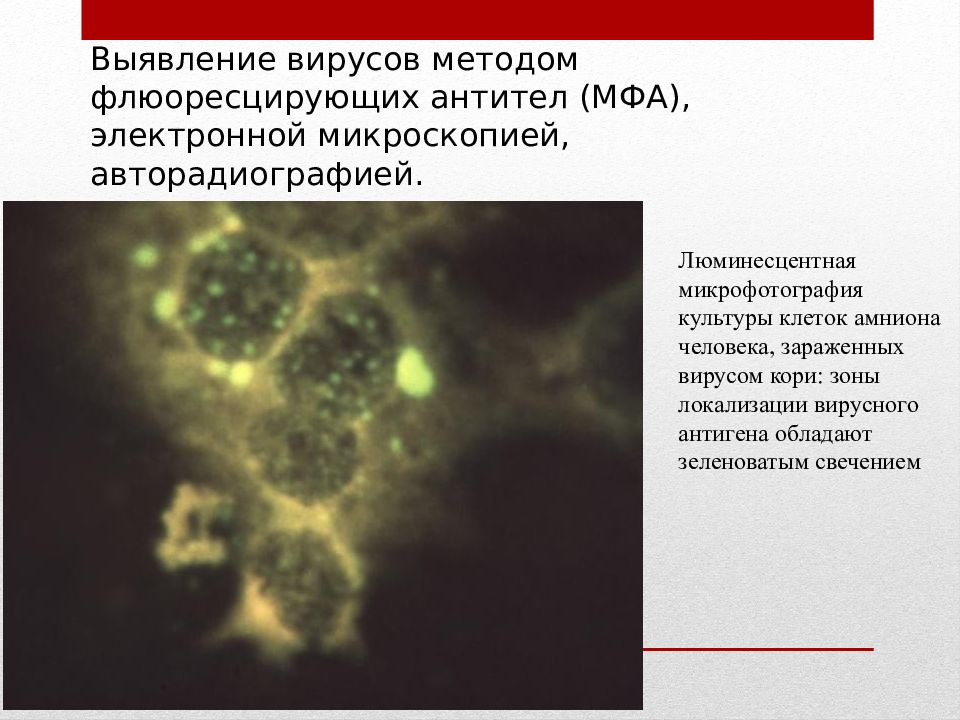 Выявление вируса. Люминесцентная микроскопия вирусы. МФА метод флюоресцирующих антител. Метод флюоресцирующих антител вирус. МФА метод флюоресцирующих антител микроскопия.