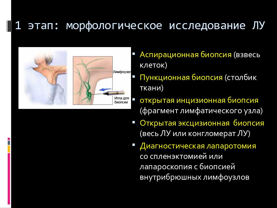 Конгломерат узлов. Трепанобиопсия лимфатического узла. Инцизионная биопсия кожи. Тонкоигольная аспирационная биопсия мягких тканей. Показания к биопсии лимфатических узлов.