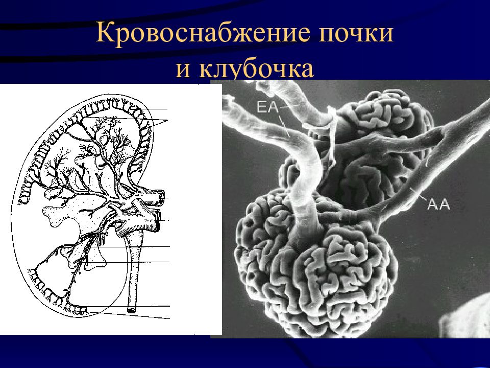 Патология почек презентация