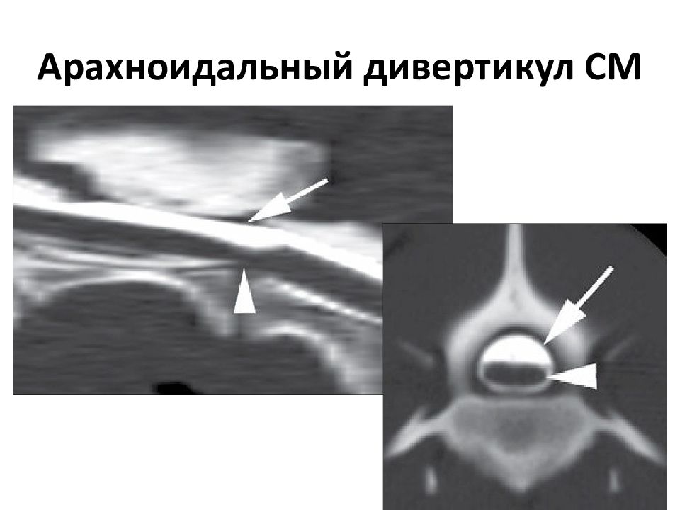 Компьютерная томография в неврологии презентация