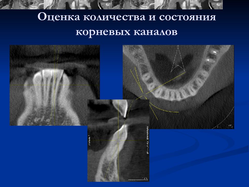 Рентгенодиагностика в стоматологии презентация