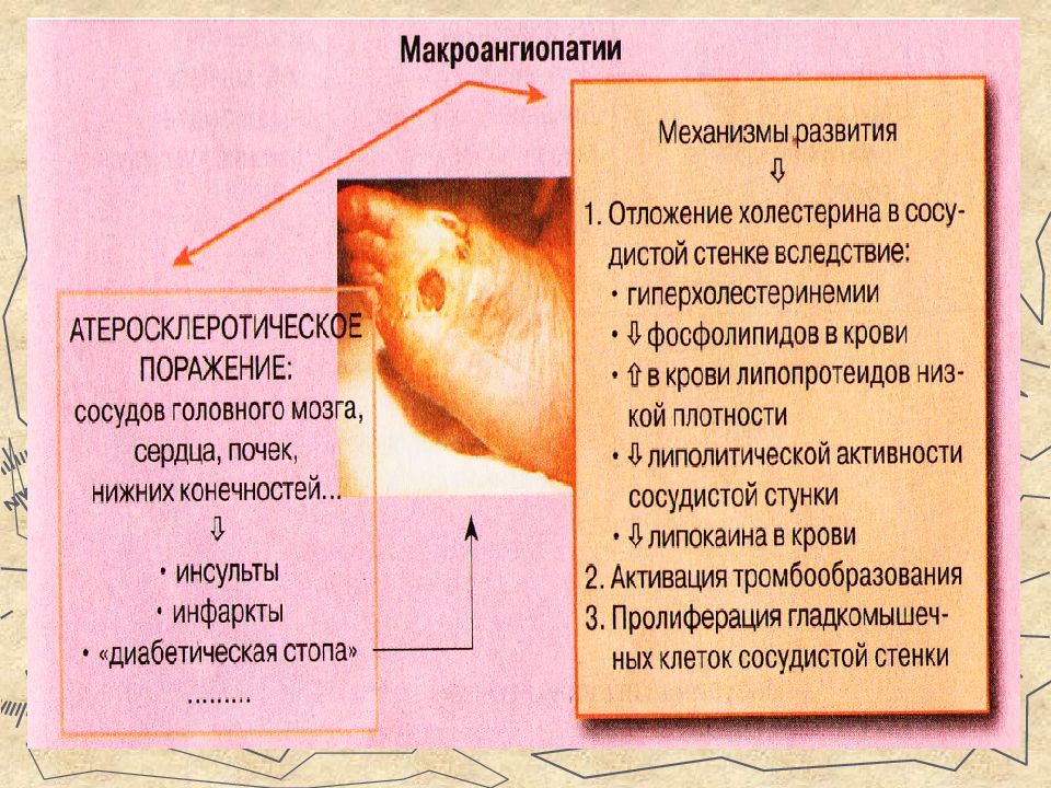 Нарушение основного обмена презентация