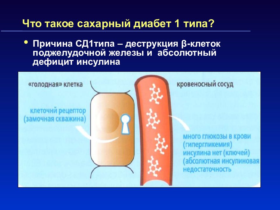 Сахарный диабет 2 типа презентация