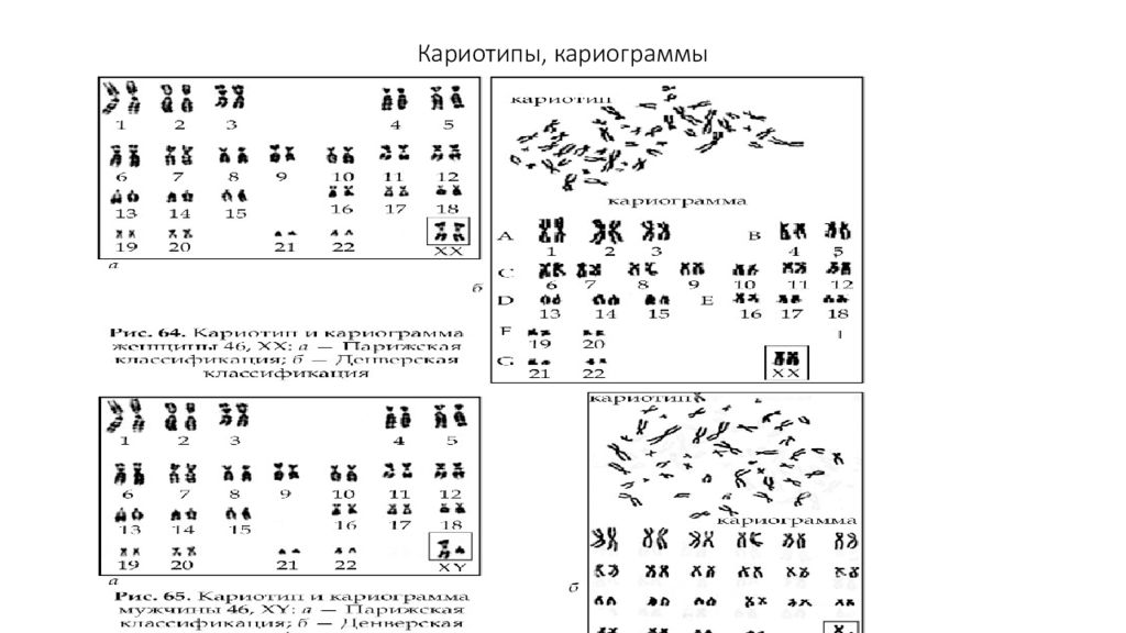 Хромосомный набор кариотип человека рисунок. Кариотип и кариограмма. Кариограмма хромосом. Идиограмма хромосом человека. Кариотип и кариограмма.
