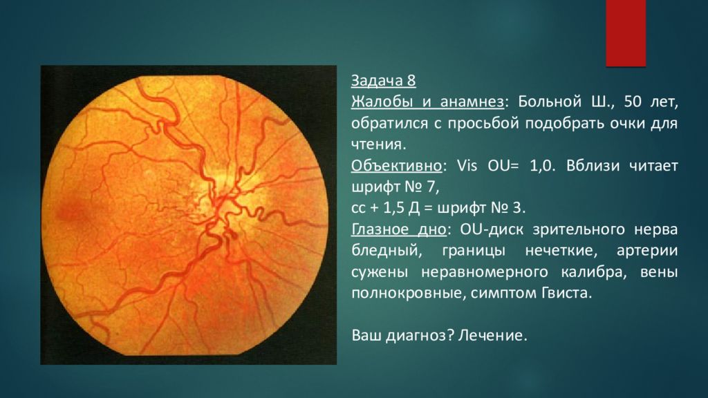 Сужение сосудов глаз. Ангиопатия сетчатки глазное дно. Офтальмоскопическая картина глазного дна. Ишемическая нейропатия глазное дно. Гемералопия глазное дно.
