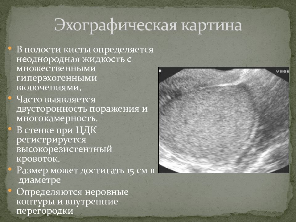 Возможности визуализации и ультразвуковая картина матки и придатков в норме