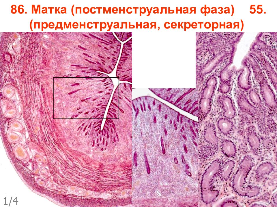 Матка гистология. Матка предменструальный период препарат гистология. Постменструальная фаза гистология препарат. Матка поперечный срез гистология.