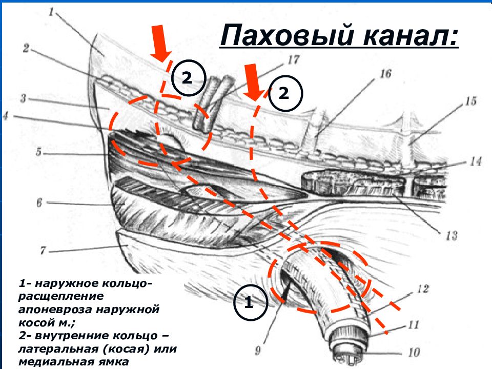 Паховый канал у детей. Паховый канал топографическая анатомия схема. Стенки пахового канала топографическая анатомия. Схема топографии пахового канала. Паховый канал внутреннее кольцо.