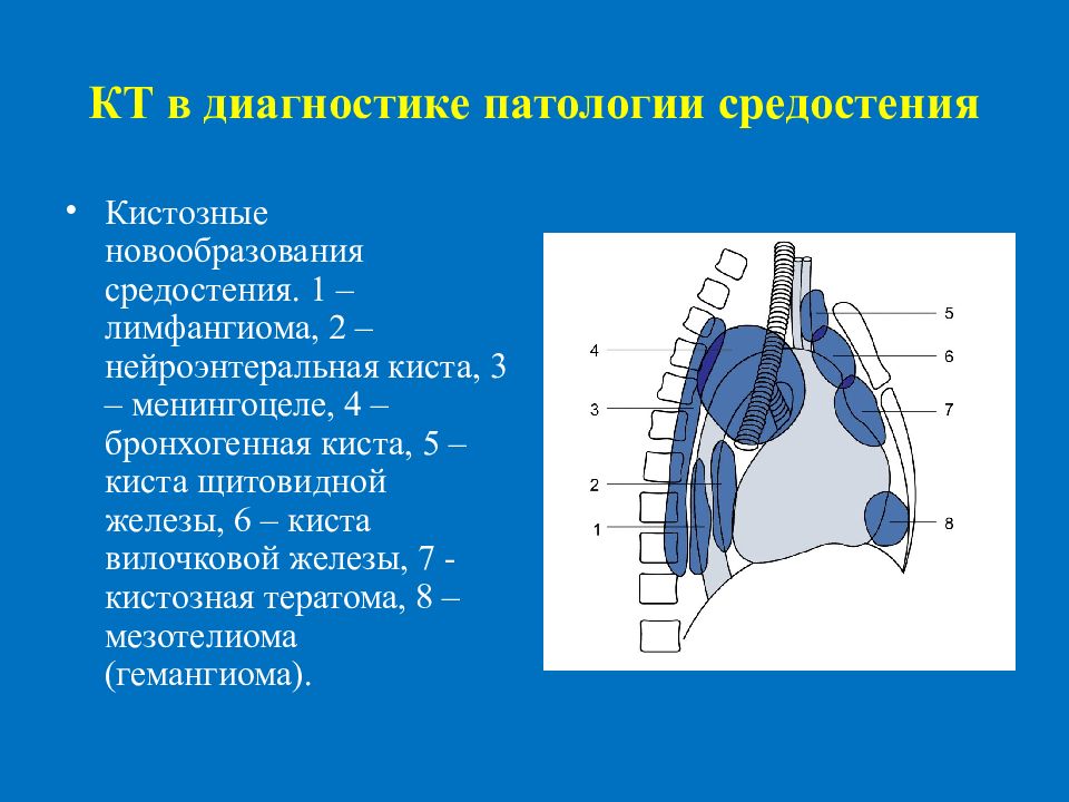 Образования средостения схема