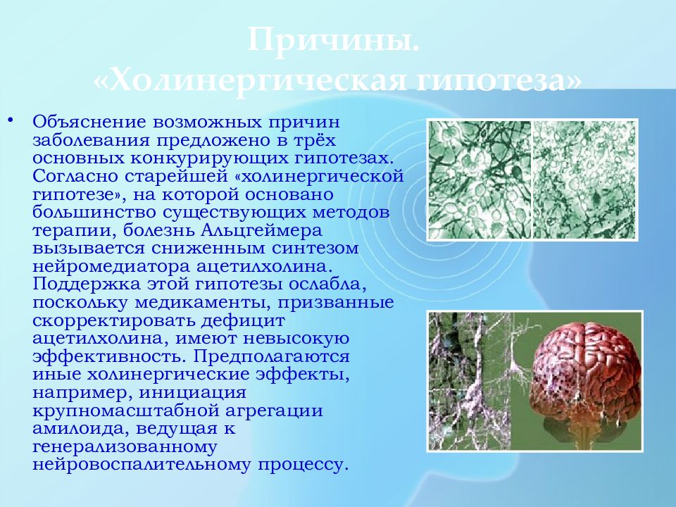 Холинергическая гипотеза болезни Альцгеймера. Болезнь Альцгеймера презентация. Презентация по болезни Альцгеймера. Реферат на тему болезнь Альцгеймера. Если против какой нибудь болезни предлагается