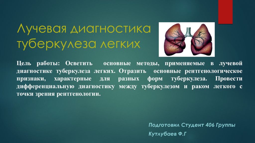 Легкие диагнозы. Лучевые методы диагностики туберкулеза. Лучевая диагностика туберкулёза лёгких. Методы лучевой диагностики легких. Методы лучевой диагностики туберкулеза легких..