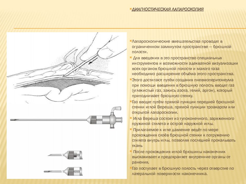 Гироскопия гинекология