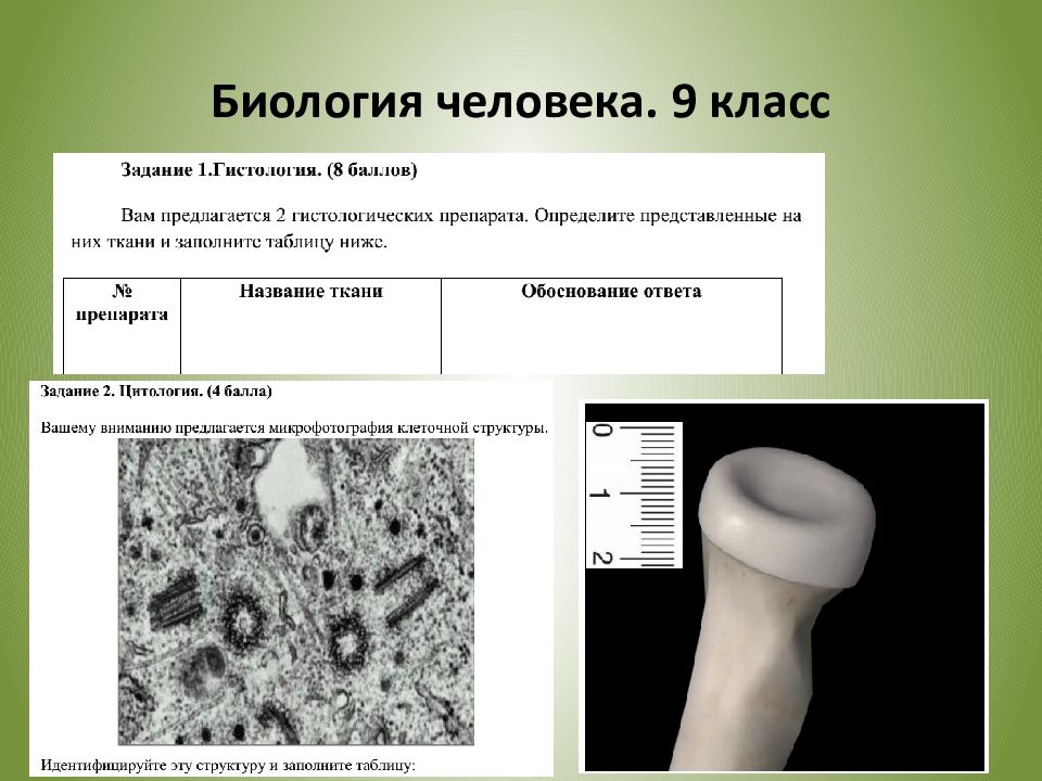 Процесс какого продукта запечатлен на фотографии. Человек определение в биологии. Гистология биология картинка 5 класс. Какой процесс запечатлен на фотографии биология. По микрофотографии определите ткань заполните таблицу.