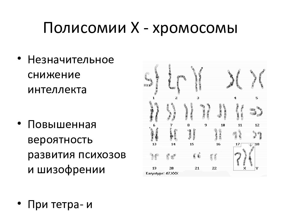 Х хромосома. Полисомия кариотип. Кариотип полисомии х. Синдром полисомии по х-хромосоме кариотип. Синдром полисомии по y-хромосоме кариотип.