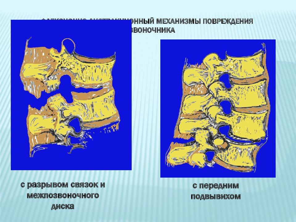 Повреждения таза презентация