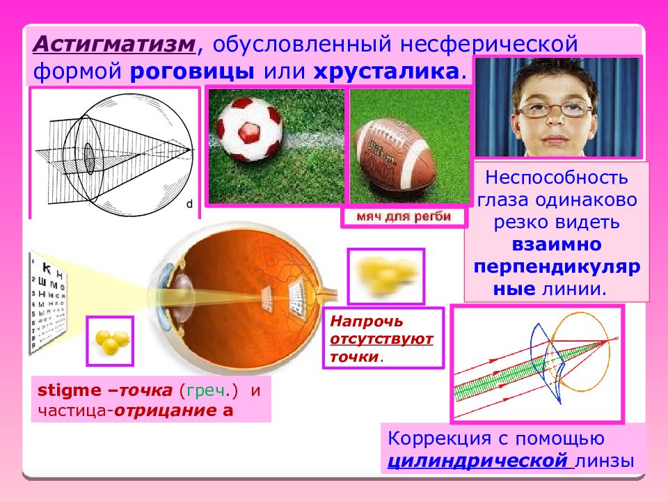 Астигматизм это простыми словами. Астигматизм роговицы. Оптический астигматизм. Астигматизм оптической системы. Цилиндрический астигматизм.