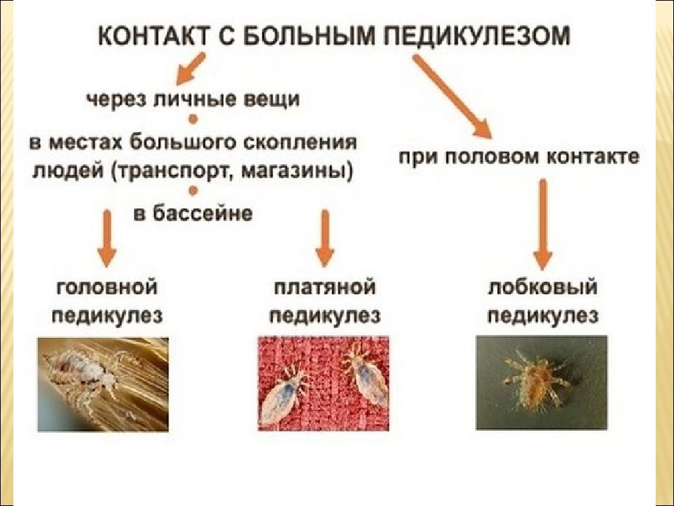 Заражение педикулезом