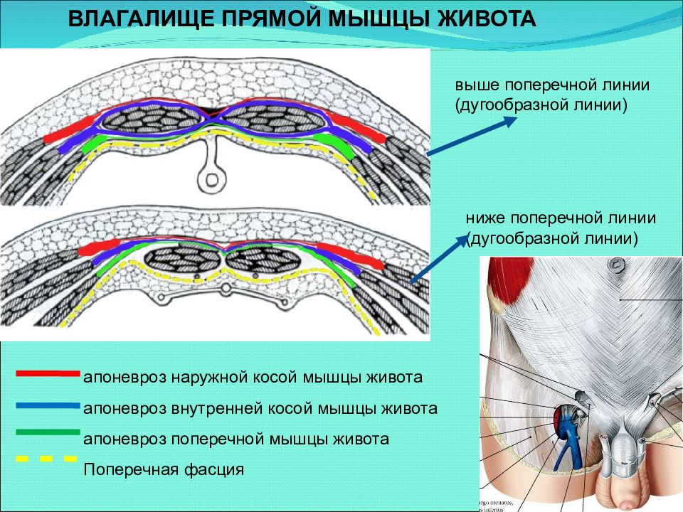 Внутренние линии. Апоневроз наружной косой мышцы живота. Влагалище прямой мышцы живота анатомия. Сухожильное влагалище прямой мышцы живота. Влагалище прямой мышцы живота схема.