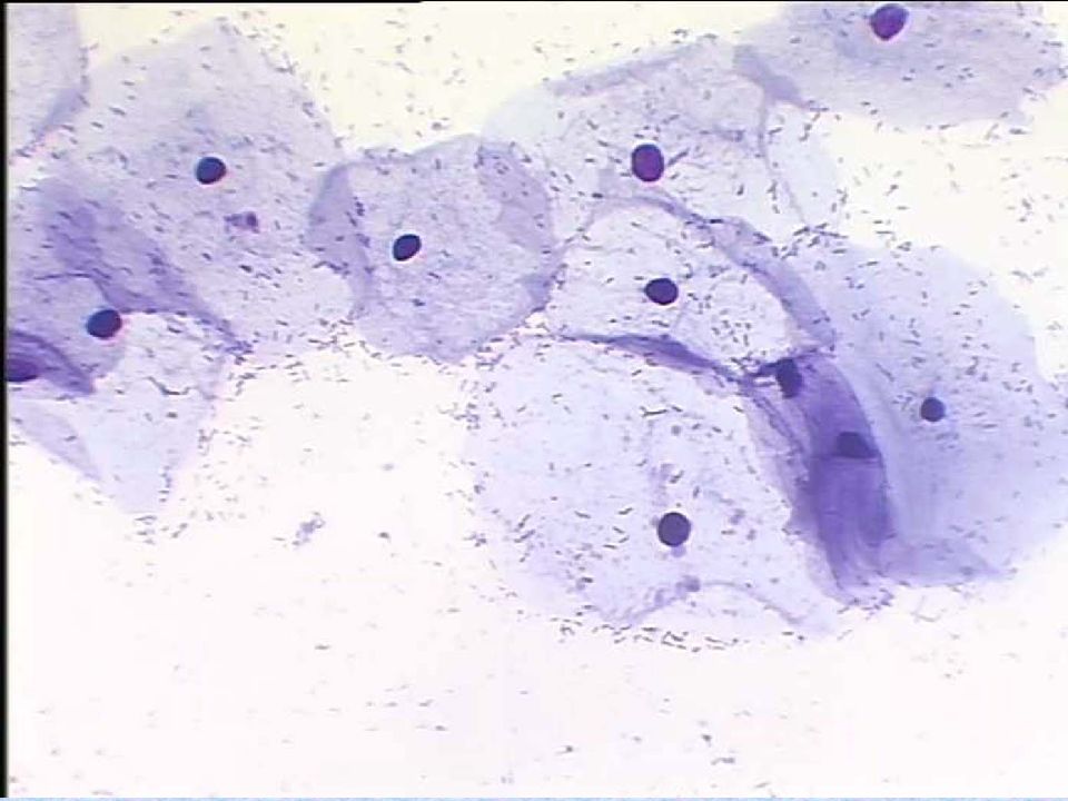 Ключевые клетки в мазке у женщин фото под микроскопом