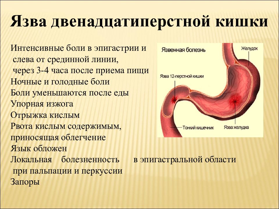 Абдоминальная боль дифференциальный