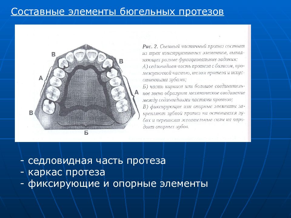 Составные элементы бюгельных протезов презентация