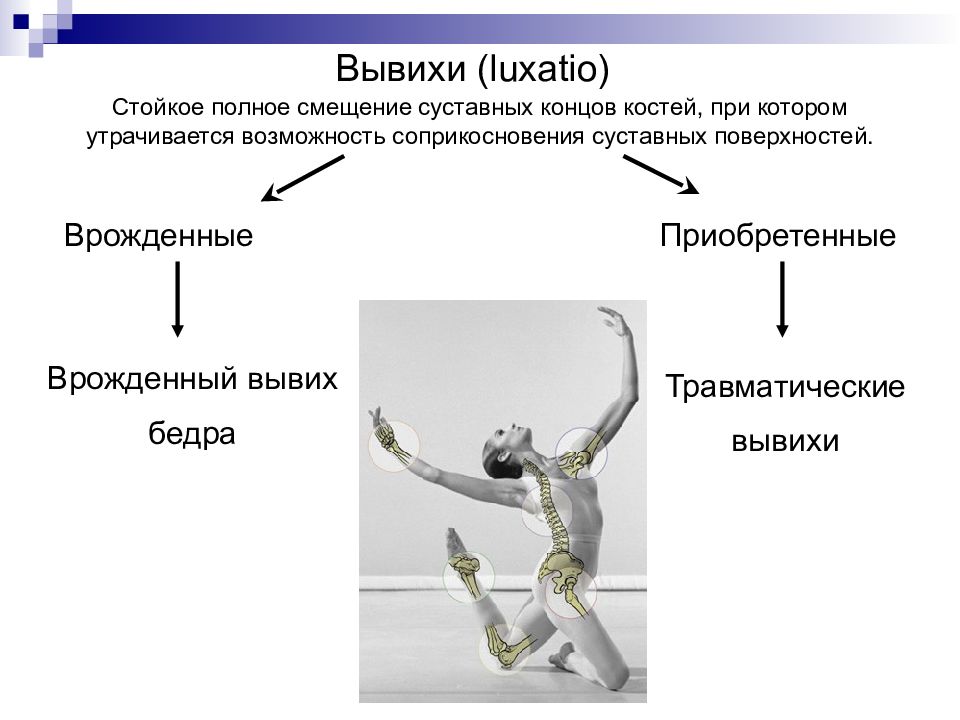 Стойкое смещение суставных концов. Презентации по травматологии. Вывихи бедра классификация. Полное стойкое смещение суставных поверхностей костей.