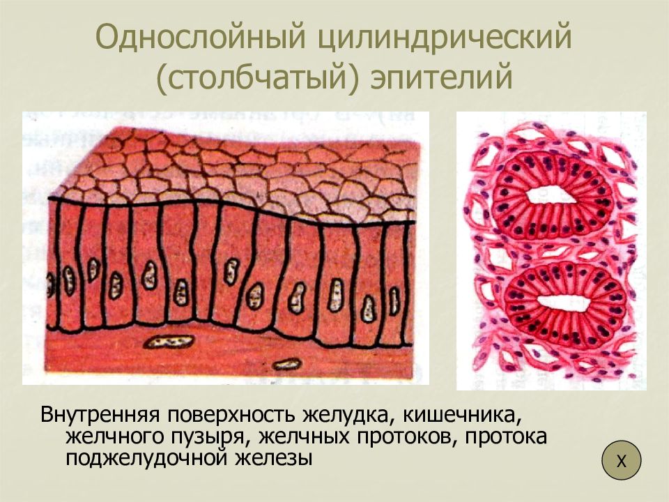 Клетки эпителия кишечника рисунок