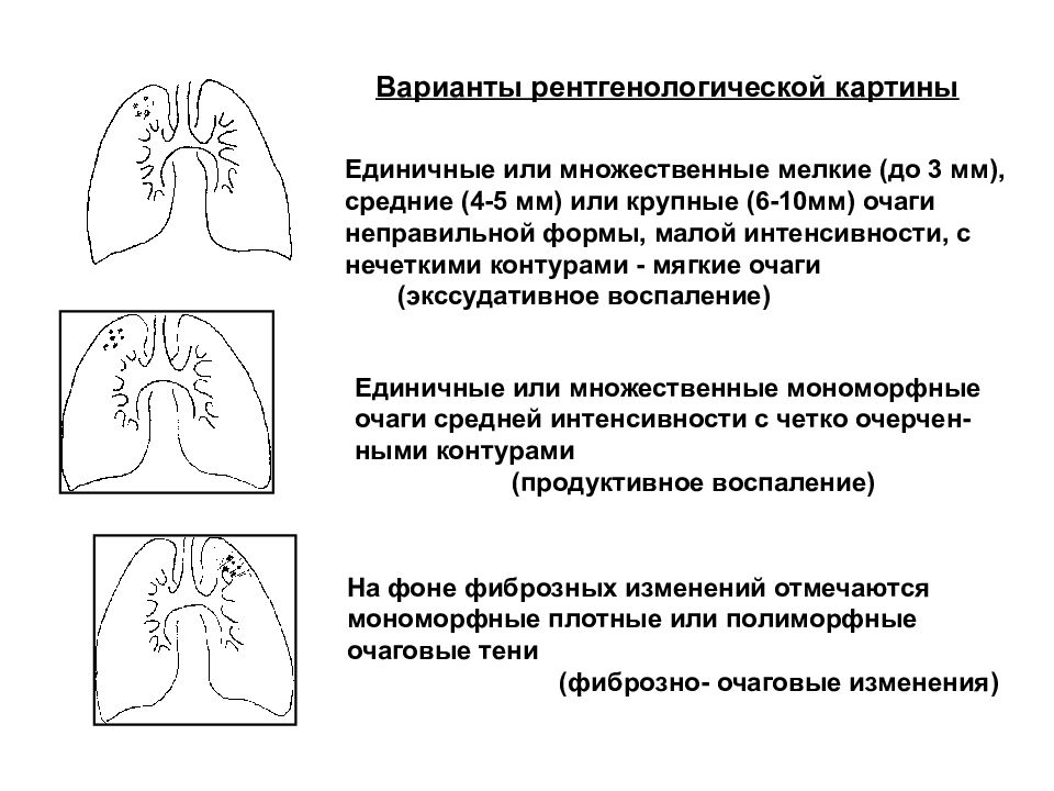 Картина очаговых