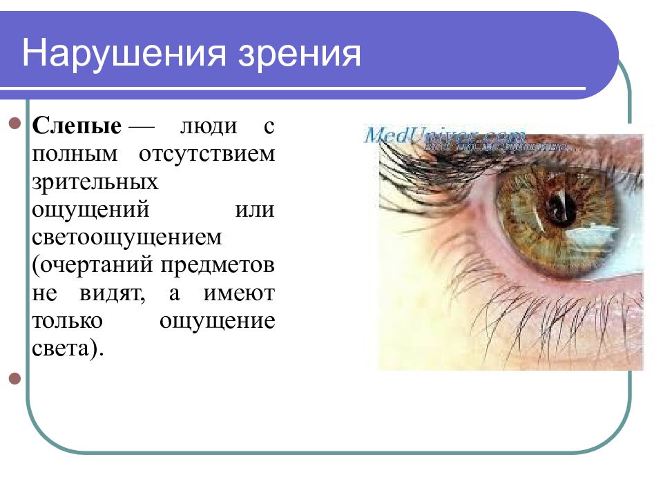 Как называется нарушение зрения при котором зрительное восприятие человека соответствует рисунку 2