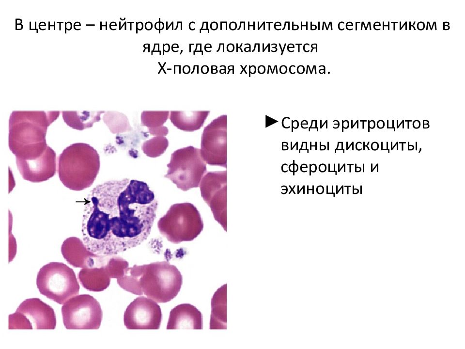 Тельца барра. Сегментоядерные нейтрофилы строение. Строение нейтрофилов крови. Тельце Барра в нейтрофилах. Незрелые нейтрофилы.