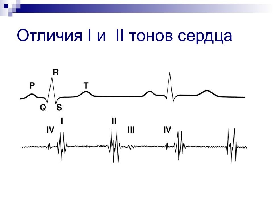 Тоны сердца причины. Тоны сердца. Звуковые тоны сердца. Тоны сердца в норме и патологии. Глухие тоны сердца.