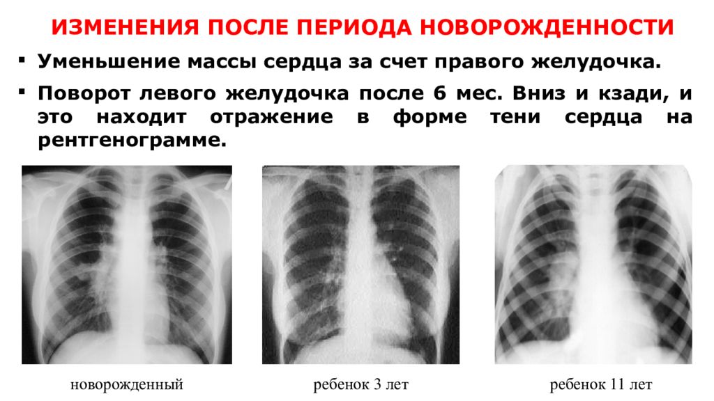 Изменения сердца после периода новорожденности. Уменьшение массы сердца. Выраженное уменьшение массы сердца.. Изменение массы сердца и его строения у ребёнка.