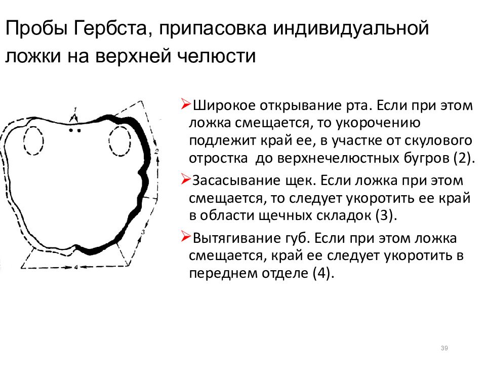 Индивидуальная проба. Функциональные пробы Гербста на верхней челюсти. Функциональные пробы в ортопедической стоматологии. Функциональные пробы по методике Гербста.