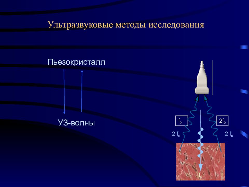 Ультразвуковые методы исследования