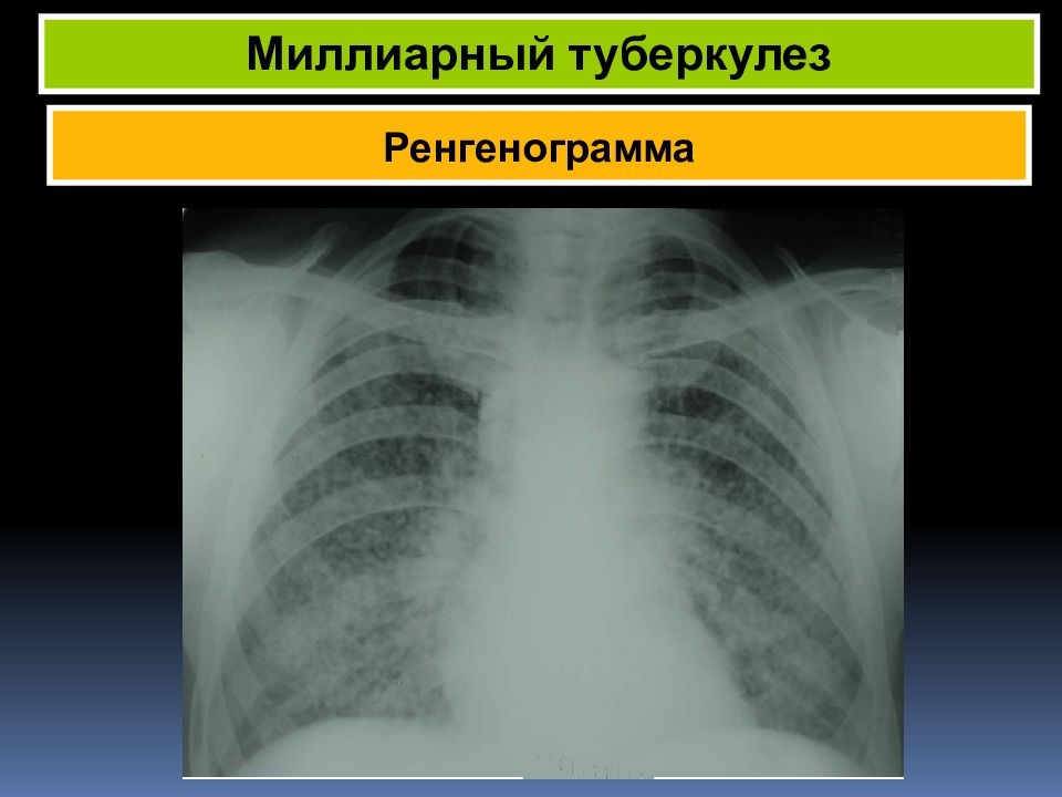 Центр фтизиатрии