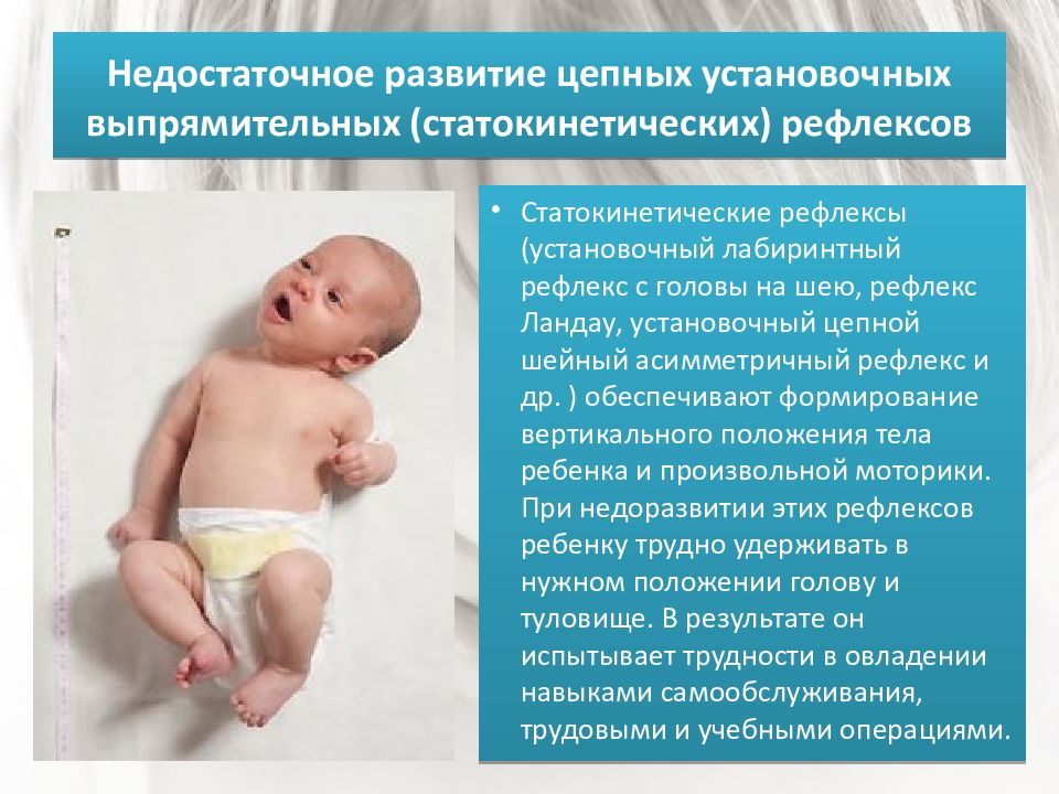 Рефлексы равновесия. Детский церебральный паралич симптомы. ДЦП симптомы у новорожденного. Симптомы ДЦП У ребенка в 2 месяца. ДЦП симптомы у грудничков в 3 месяца.