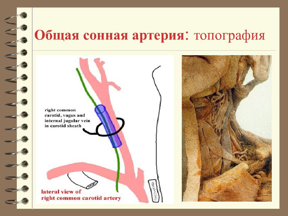 Схема сонных артерий человека