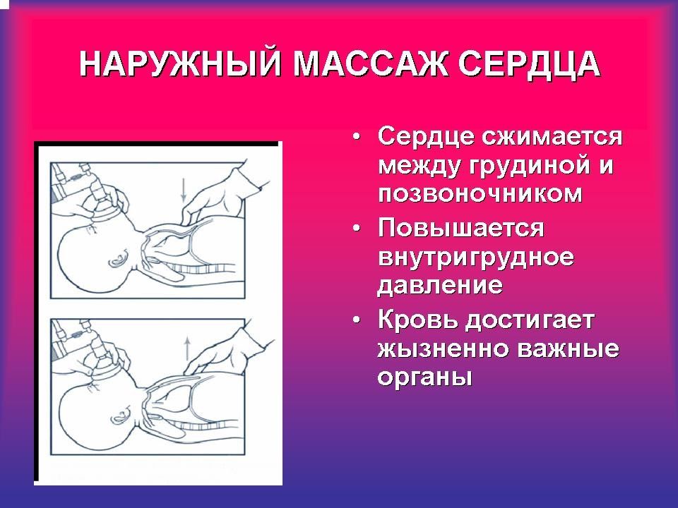 Гипоксия плода и асфиксия новорожденного презентация