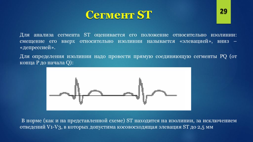 Нормальное экг презентация