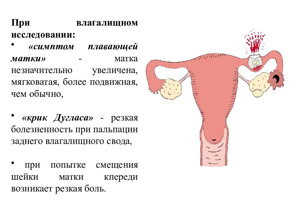 Сосудистый рисунок выражен в матке что это значит