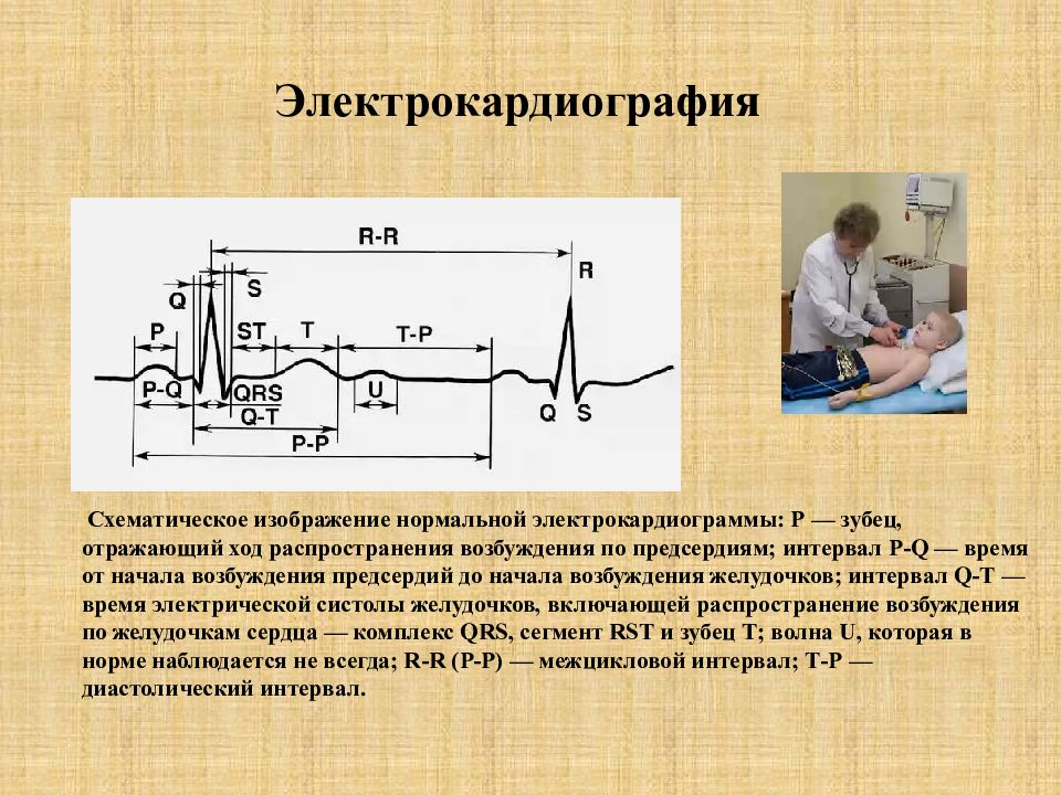 Проведение экг. Электрокардиография. Схематическое изображение электрокардиограммы. Схематическое изображение нормальной электрокардиограммы. ЭКГ определение.