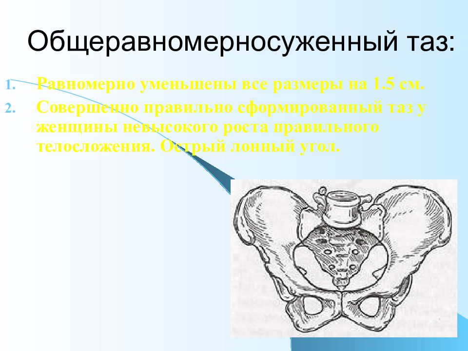 Расширение таза у женщин