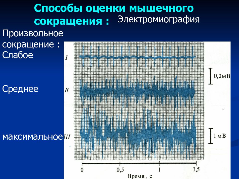 Частота сокращения мышц человека. Электромиография. Электромиография скелетных мышц. Электромиография график. Частота сокращения мышц.