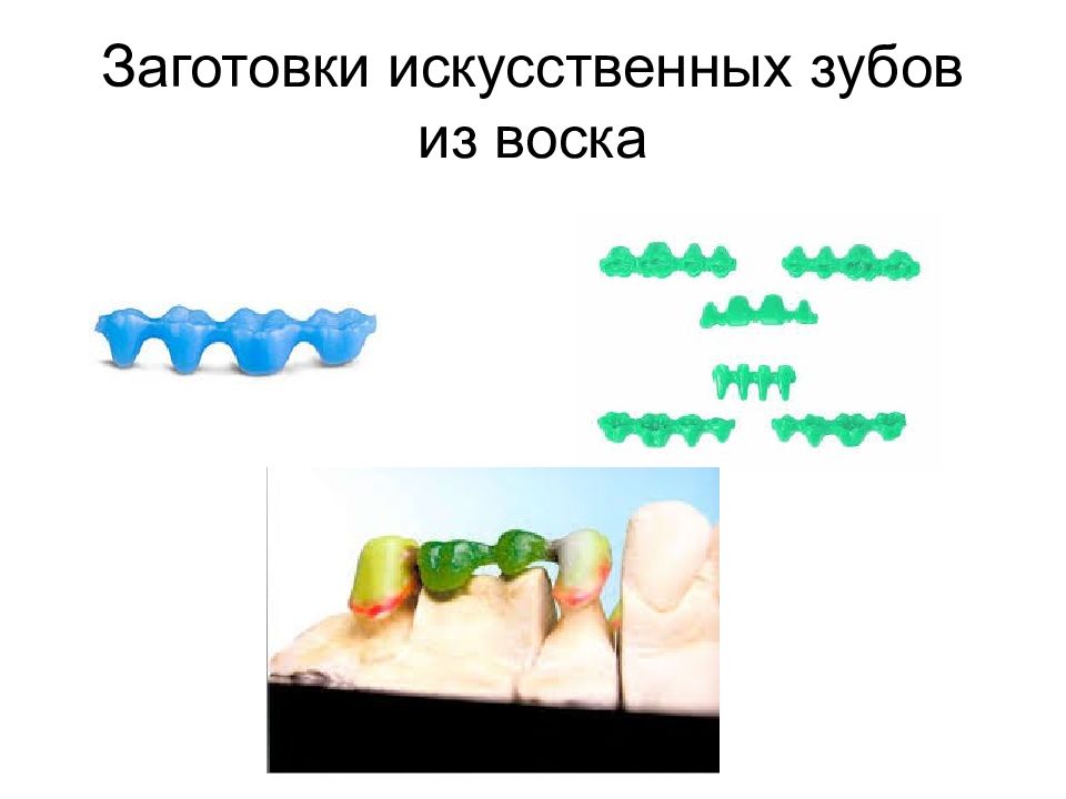 Моделировочные материалы в стоматологии презентация