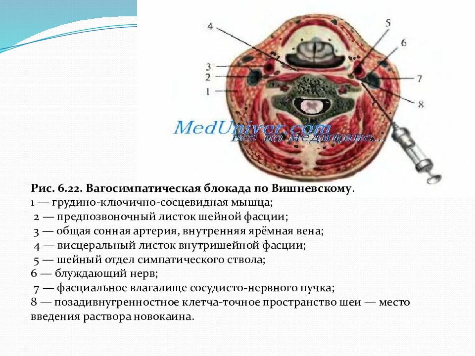 Вагосимпатическая блокада по вишневскому презентация