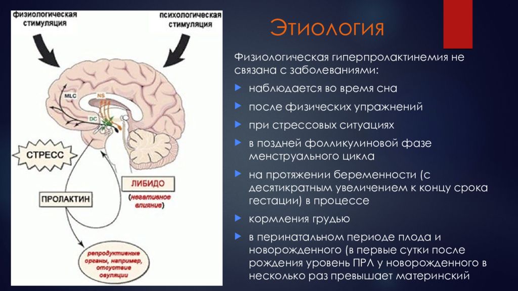 Презентация на тему гиперпролактинемия